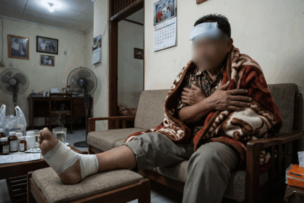 Cara Merawat Luka Diabetes Basah di Rumah agar Cepat Kering dan Mencegah Bahaya Amputasi